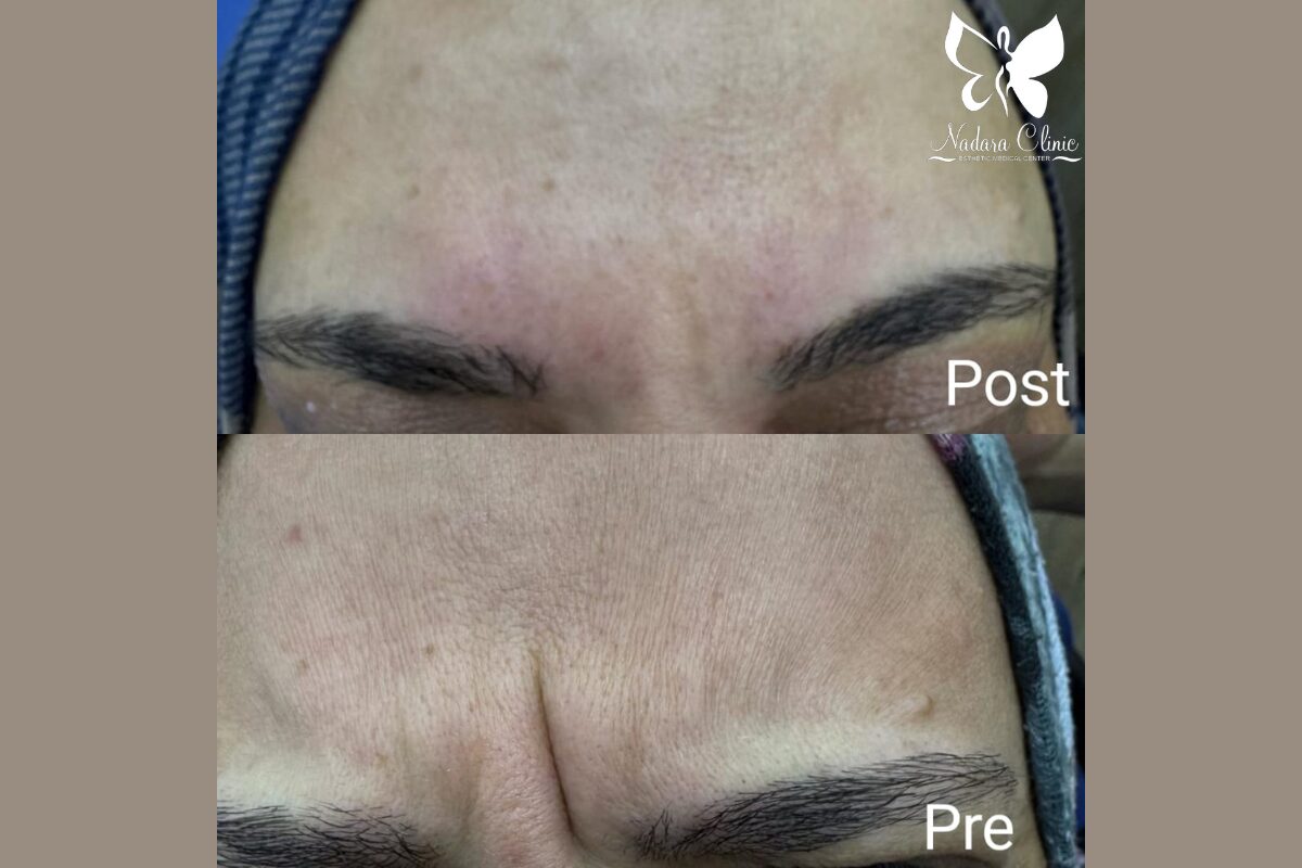 بوتكس ديسبورت في الغردقة